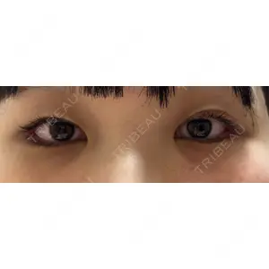 口コミ