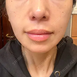 筋肉・美容クリニック口コミ