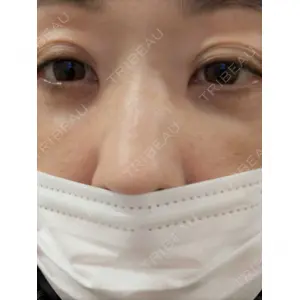 東京BELLEZZAクリニック口コミ