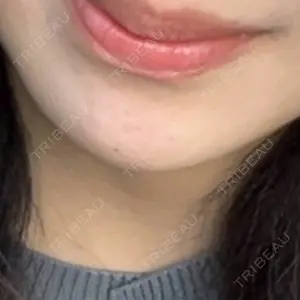 フォンタナクリニック天神口コミ