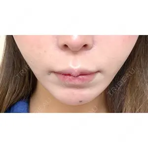 口コミ