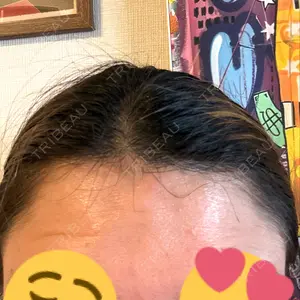 TCB東京中央美容外科 TCB東京中央美容外科 渋谷東口院口コミ