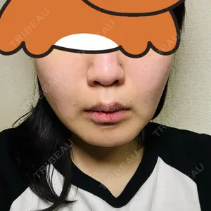 口コミ