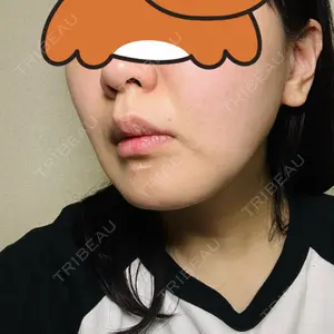 口コミ
