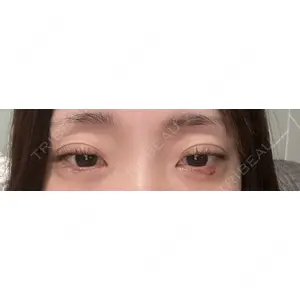 新未来クリニック口コミ