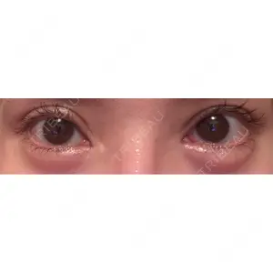 口コミ