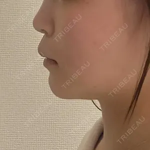 Re:anne clinic 銀座 【リアンクリニック銀座】口コミ