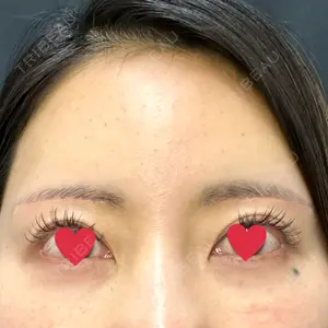 YBC横浜美容外科 YBC横浜美容外科 池袋院口コミ