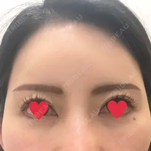 YBC横浜美容外科 YBC横浜美容外科 池袋院口コミ