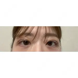 口コミ