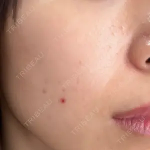 心斎橋KT美容クリニック口コミ