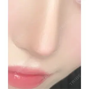 LUHO（ルホ）美容外科口コミ