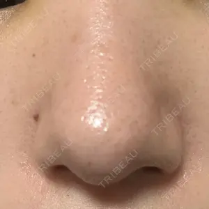 口コミ