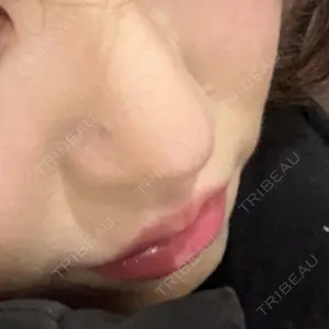 LUHO（ルホ）美容外科口コミ