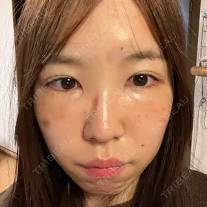東京シンデレラ美容外科 東京シンデレラ美容外科 池袋院口コミ