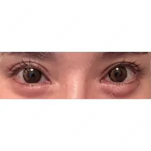 口コミ