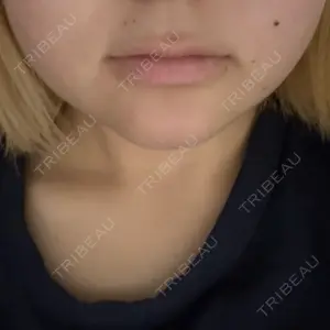 フォンタナクリニック天神口コミ