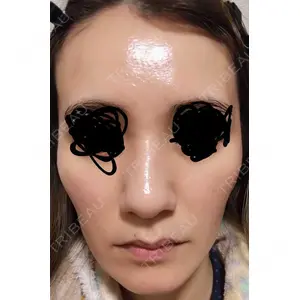 心斎橋KT美容クリニック口コミ