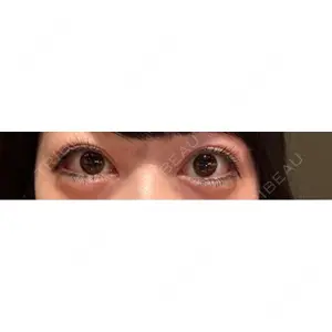 東京BELLEZZAクリニック口コミ