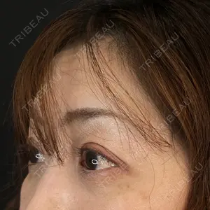 藤・ナチュレ美容クリニック 藤・ナチュレ美容クリニック 銀座院口コミ