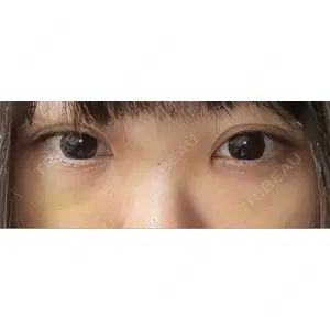 東京シンデレラ美容外科 東京シンデレラ美容外科 池袋院口コミ