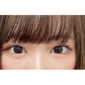 東京シンデレラ美容外科 東京シンデレラ美容外科 池袋院口コミ