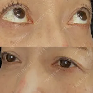 藤・ナチュレ美容クリニック 藤・ナチュレ美容クリニック 銀座院口コミ