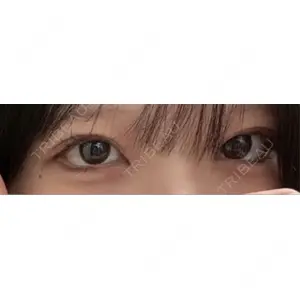 プロミス整形外科口コミ