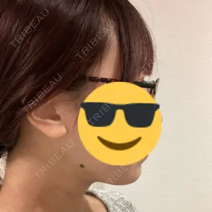 脂肪吸引ラボトウキョウ口コミ