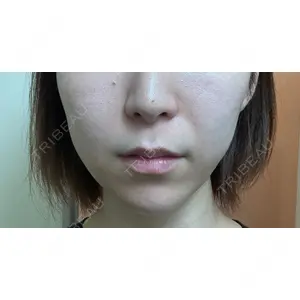 メディカルアルファクリニック口コミ