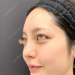 口コミ