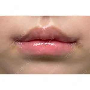 R Beauty CLINIC R Beauty CLINIC 銀座院口コミ