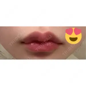 口コミ