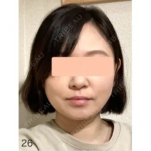 口コミ