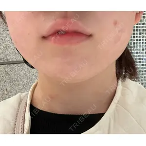 BiBiクリニック口コミ