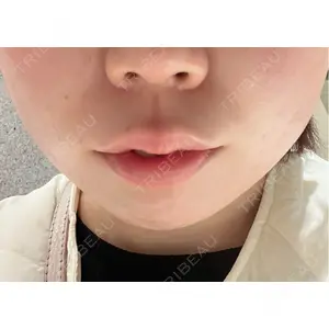 BiBiクリニック口コミ