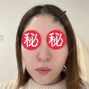 ミニマムスキンクリニック ミニマムスキンクリニック池袋口コミ