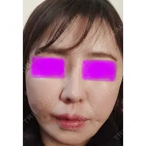 A CLINIC（エークリニック） A CLINIC（エークリニック） 新宿院口コミ