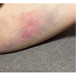 ルーチェクリニック ルーチェクリニック 銀座院口コミ