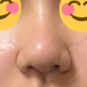 X CLINIC X CLINIC 大阪院口コミ