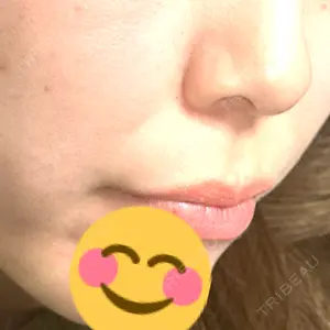 BIZENNクリニック【ビゼンクリニック】口コミ