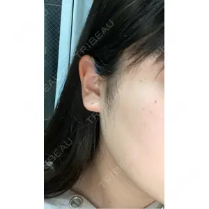 TCB東京中央美容外科 TCB東京中央美容外科 池袋駅前院口コミ