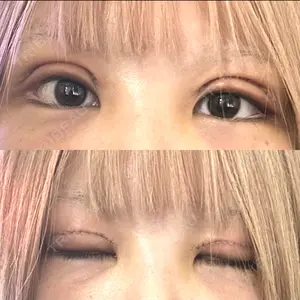 口コミ