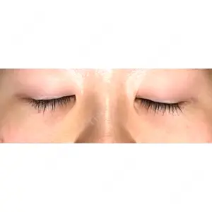 APOLLO BEAUTY CLINIC口コミ