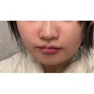 BiBiクリニック口コミ