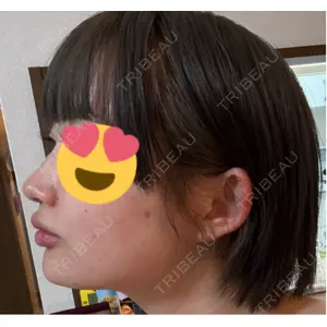 BiBiクリニック口コミ