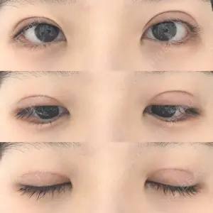 口コミ