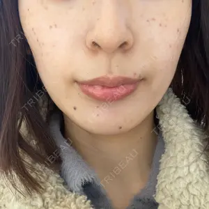 口コミ
