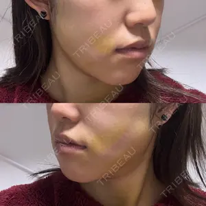 HAAB×DREAM BEAUTY CLINIC HAAB×DREAM BEAUTY CLINIC 東京本院口コミ