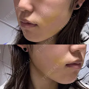 HAAB×DREAM BEAUTY CLINIC HAAB×DREAM BEAUTY CLINIC 東京本院口コミ
